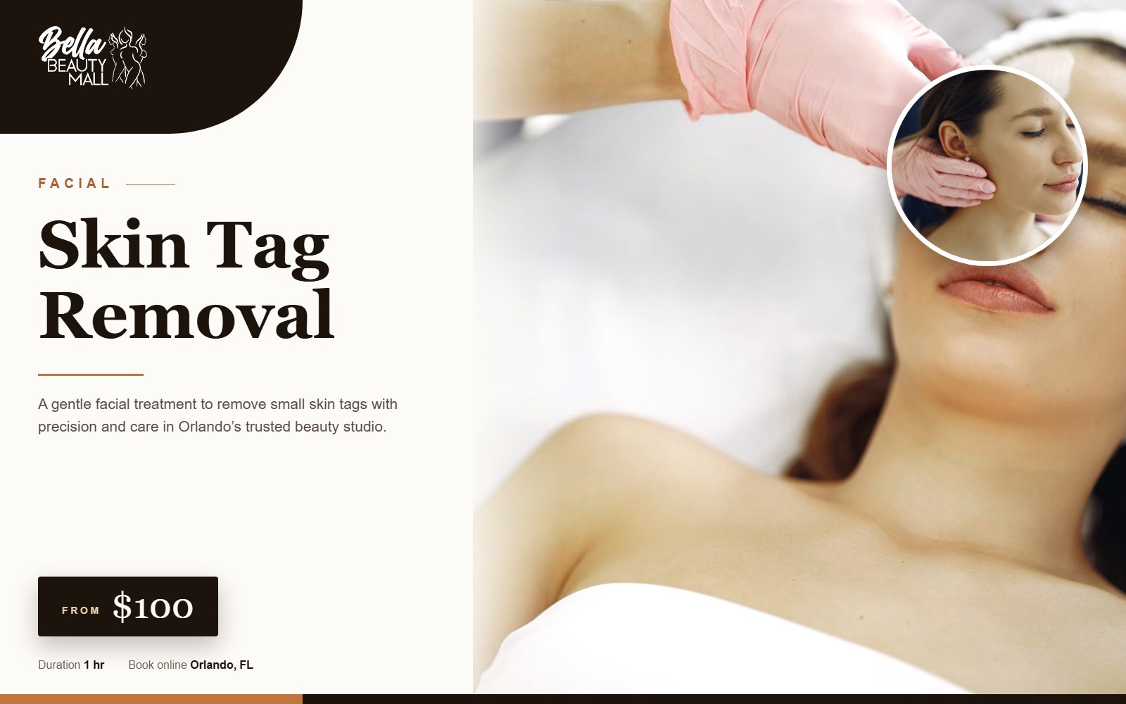 Skin Tag Removal at Bella Beauty Mall in Orlando, FL