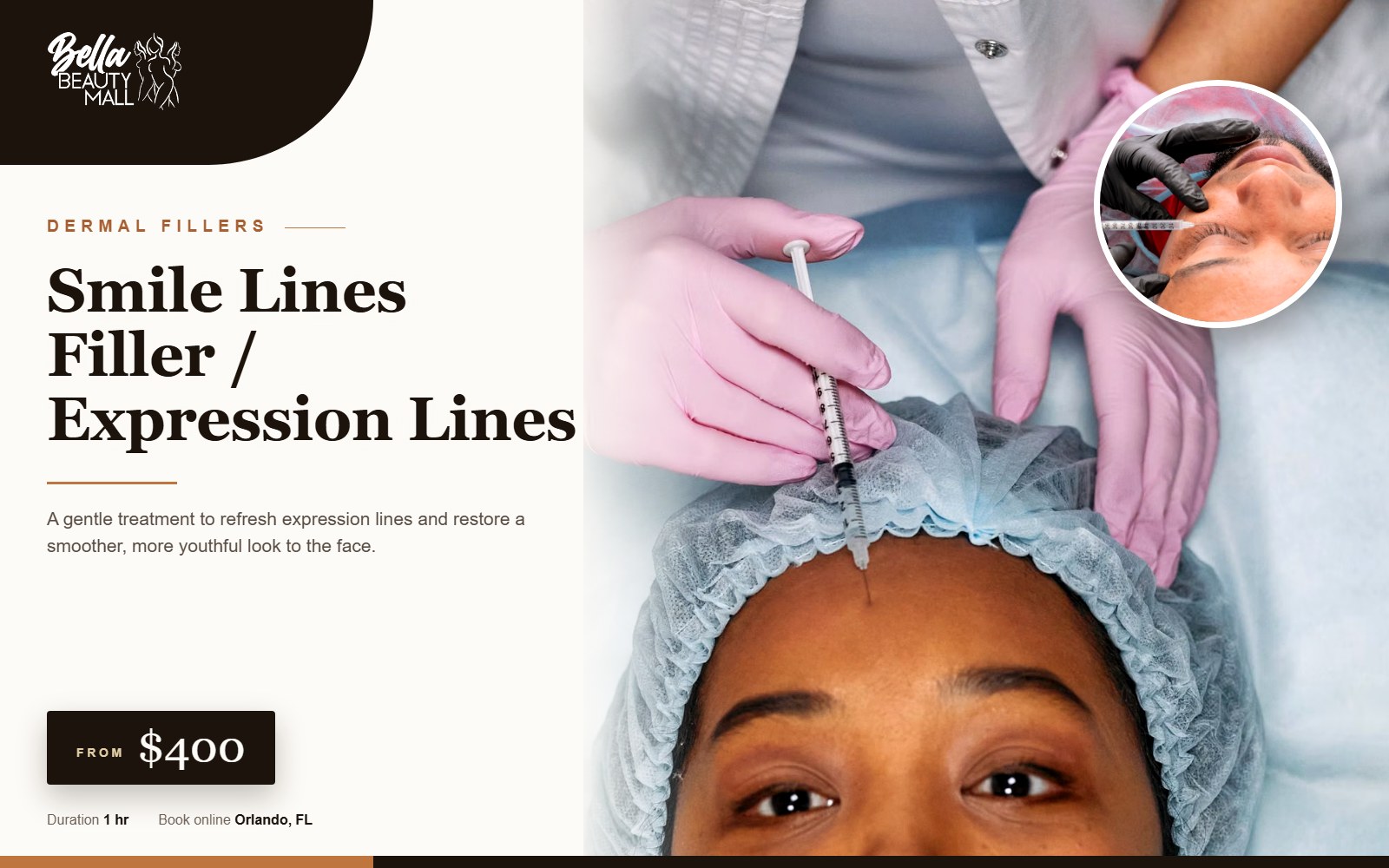 Smile Lines Filler / Expression Lines at Bella Beauty Mall in Orlando, FL